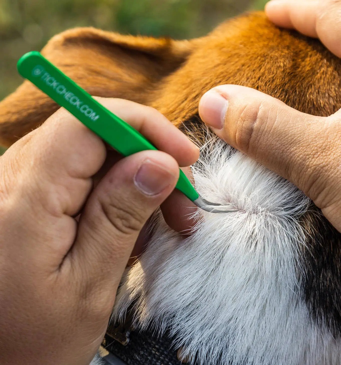 TickCheck Premium Tick Remover Kit TickCheck